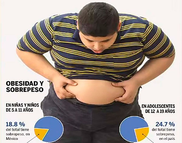 Sobrepeso infantil