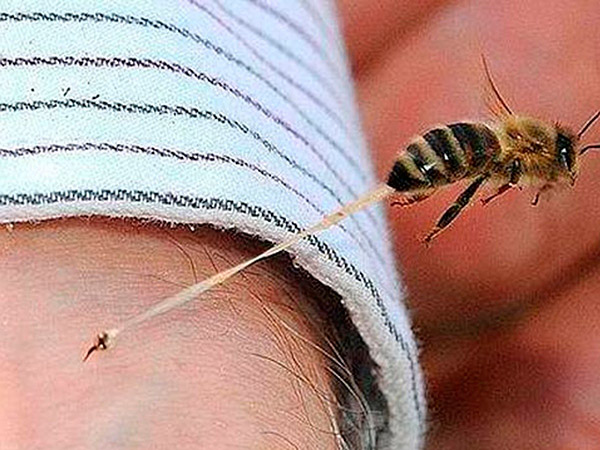 Picadura de abeja