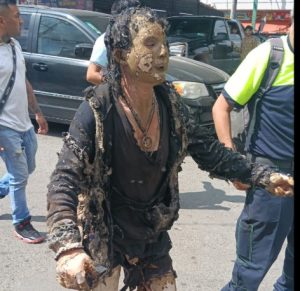 Víctima de la explosión de pipa.