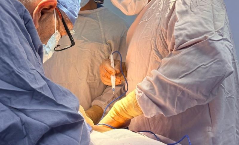 Donación de órganos