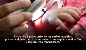 Marcas de nacimiento